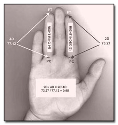 digit-ratio