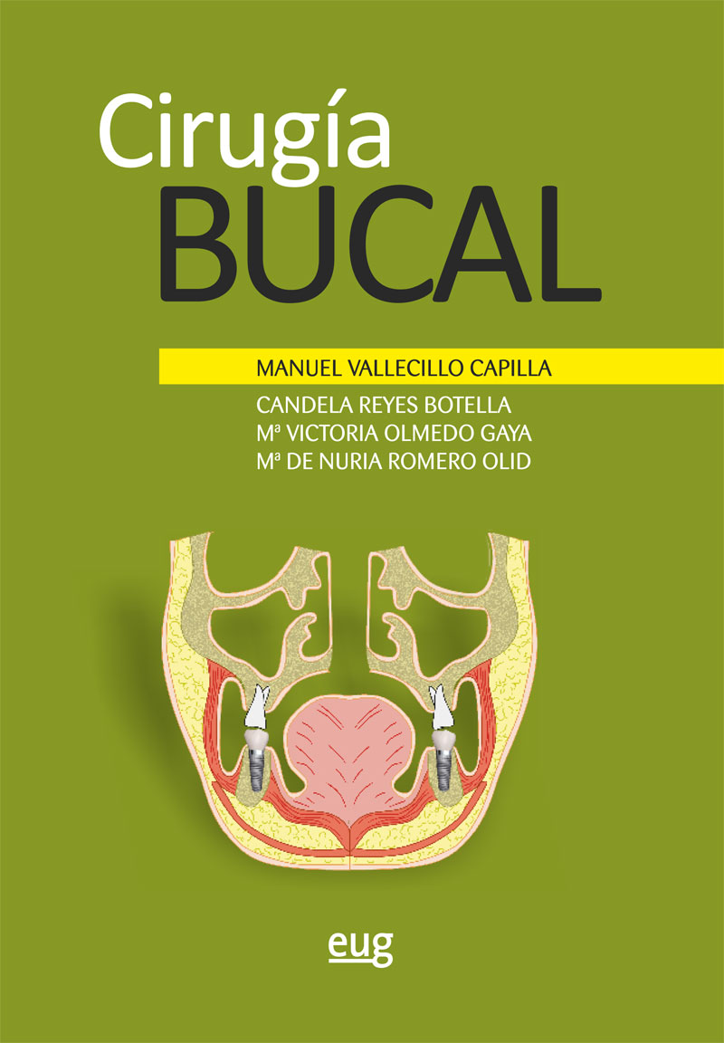 cirugiabucaleug